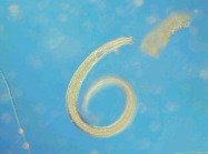 Nematoda Nematoda